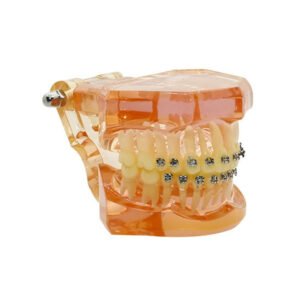 Denext Ortho Model (Half Metal and Half Ceramic Brackets)